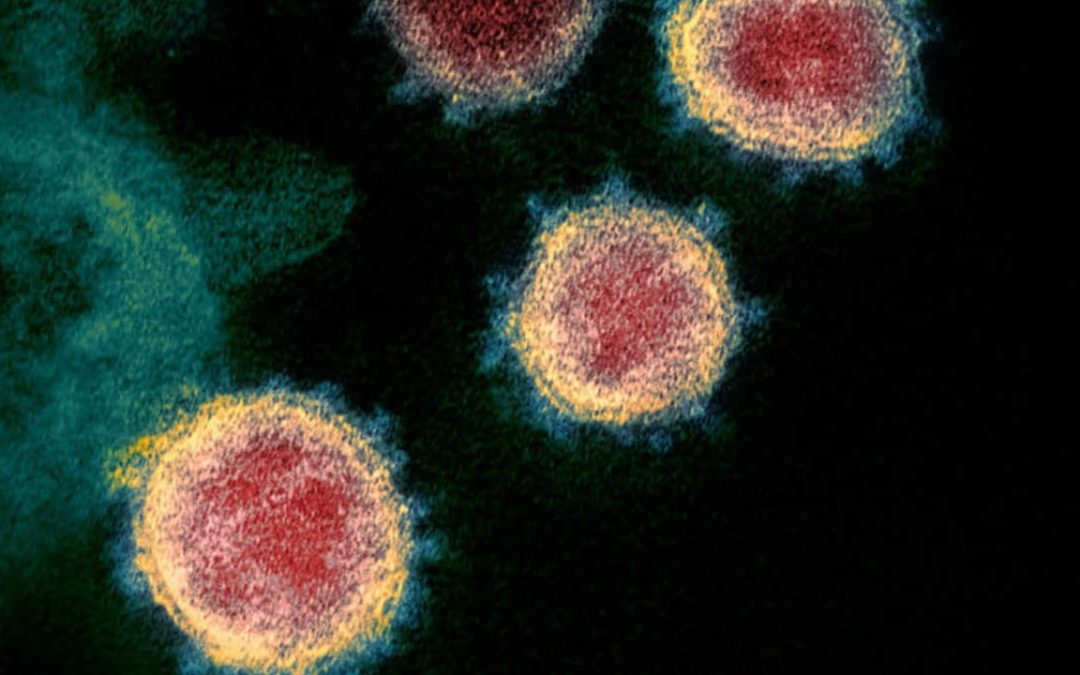 Hasta la fecha, no existen indicios que apunten a que tener el VIH implique un mayor riesgo frente al coronavirus